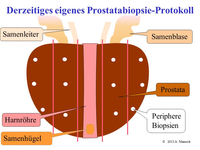 Schema der systematischen Prostatastanzbiopsie
