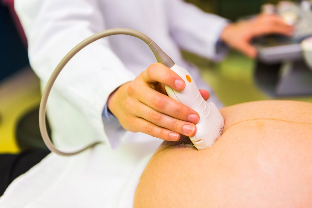 Ultraschalluntersuchung bei einer Schwangeren