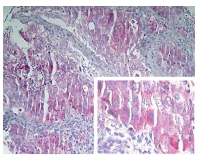 Abb. 2: Immunhistochemische Techniken sind entscheidend für die Therapie.